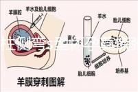 脊柱側彎s型懷孕莫慌張，能否順產還得看這4大要素