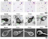 試管促排卵不同方案都適合哪些人？如何監測排卵？