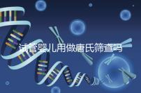 試管嬰兒用做唐氏篩查嗎,南寧費用低于兩千七