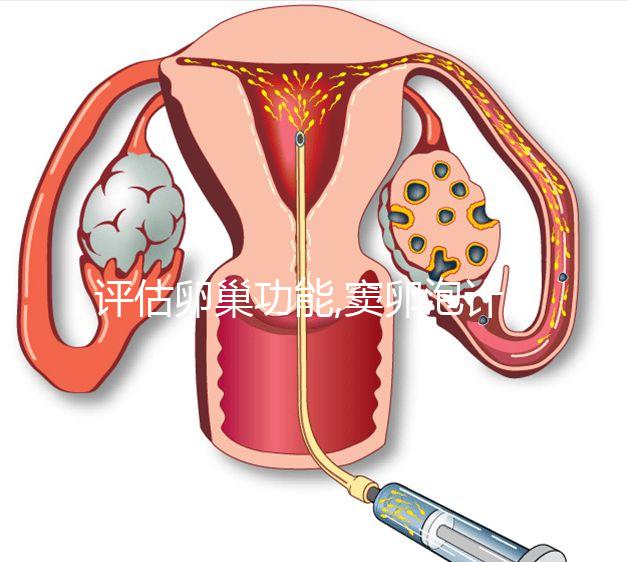 評估卵巢功能,竇卵泡計數最佳時間在月經3