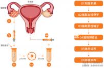 赴美考察歸來(lái)!HRC醫(yī)院的6位試管嬰兒醫(yī)生是亮點(diǎn)