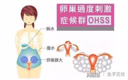 赴美試管要花多少錢?5大收費看懂美國試管嬰兒貴在哪里