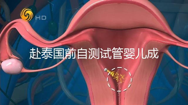 赴泰國(guó)前自測(cè)試管嬰兒成功率，這些方法值得收藏