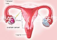 風濕關節(jié)炎(風濕關節(jié)炎的癥狀有哪些)