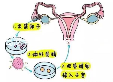 高泌乳素血癥吃多久溴隱亭?別再以為這個時候停藥最佳了
