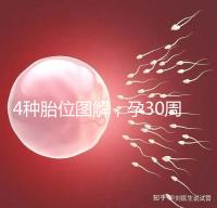 4種胎位圖解，孕30周這個姿勢最適合順產