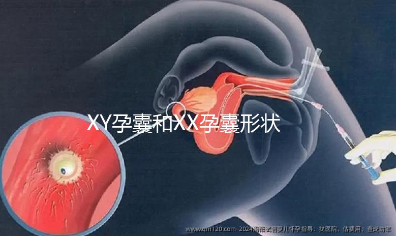 XY孕囊和XX孕囊形狀各有差異，橢圓形可能是懷女哦！