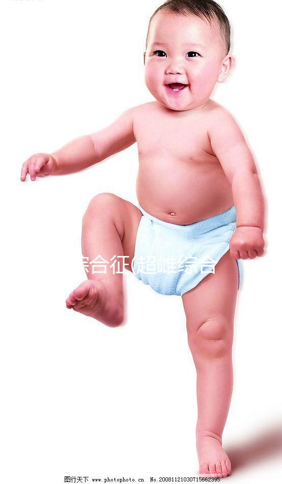 XXX綜合征(超雌綜合征)是什么？一種性染色體異常的疾病