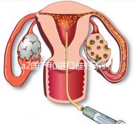 a2國產和進口誰好不糾結,看配方、口感、價格對比再選