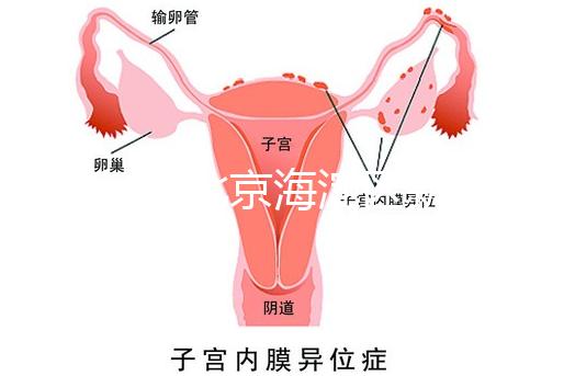 2024年北京海淀區(qū)新生兒醫(yī)療保險處理策略，照片要求不要出錯