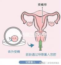 2024年西藏三胎新政策出臺,拉薩、日喀則產假戳多久?